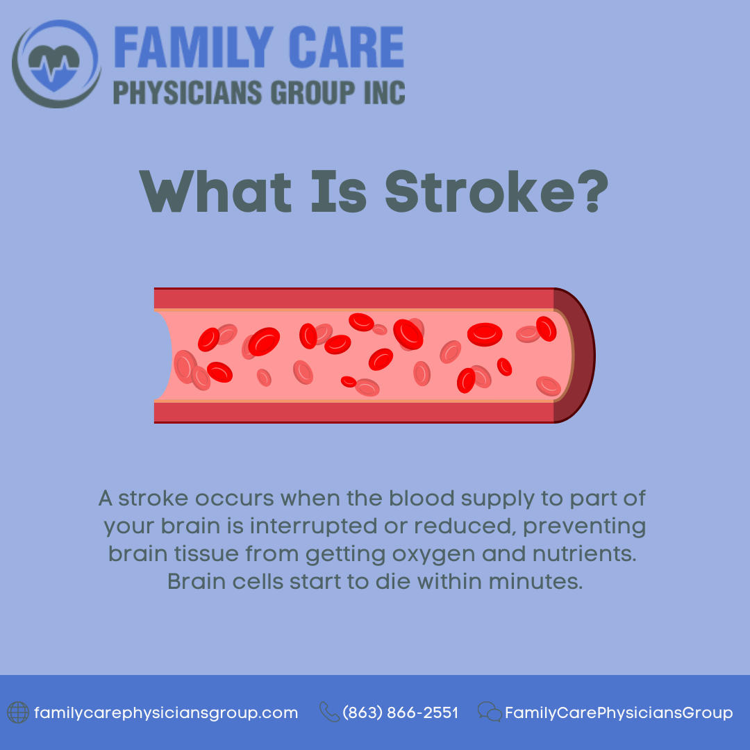 Family Care Physicians Group educational post What Is Stroke